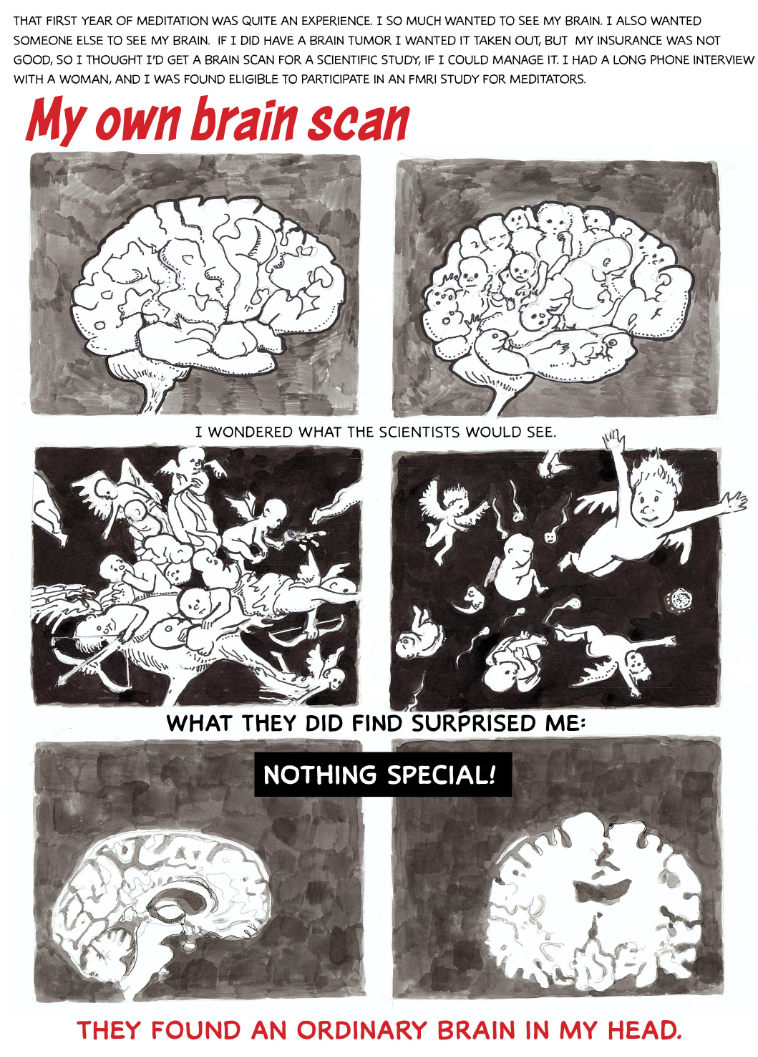 brain
              scan